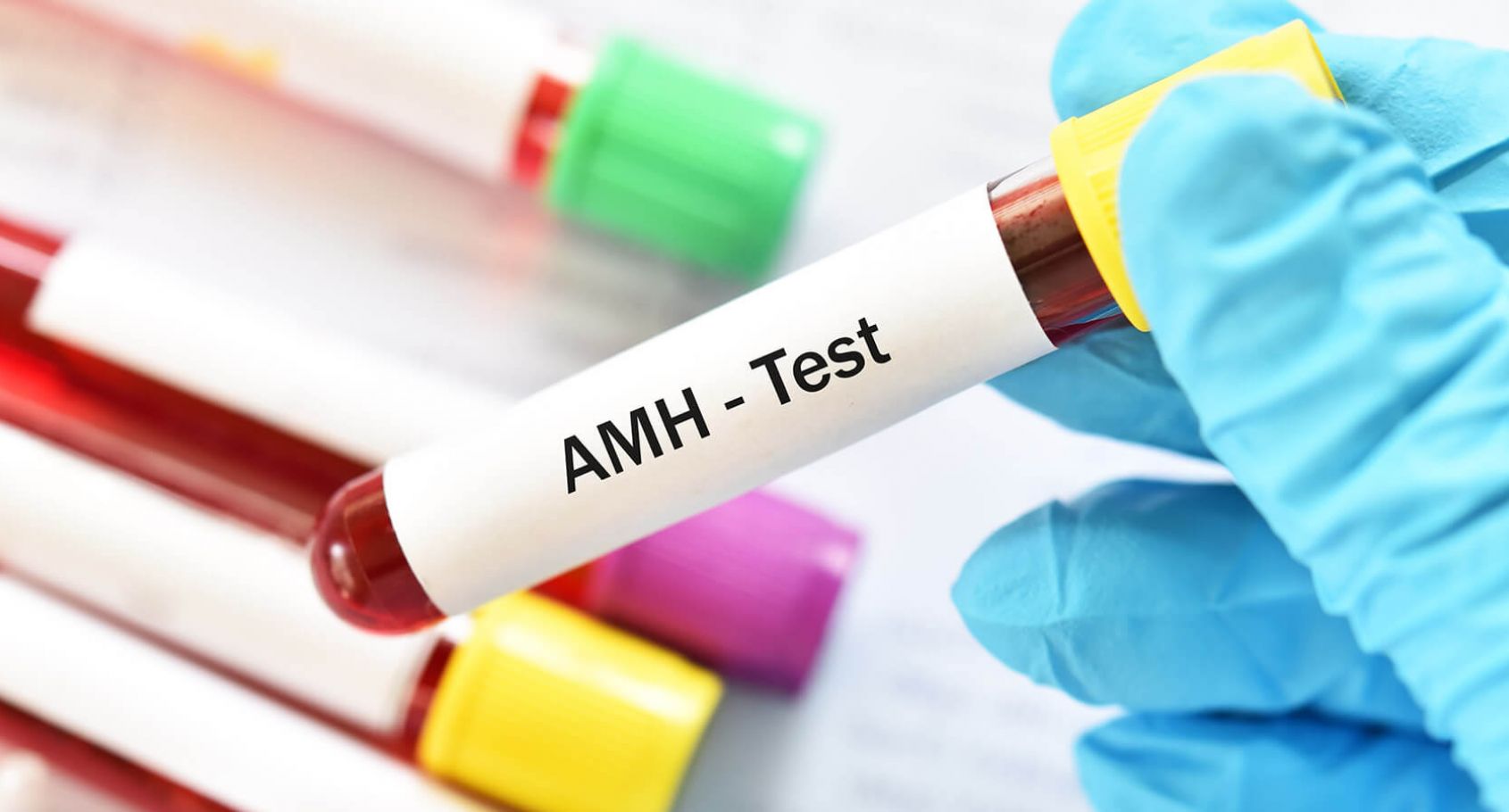 AMH – Ormone Antimulleriano